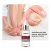 TRATAMIENTO COMPLEMENTARIO PODOLOGICO BLANQUEADOR DE UÑAS 15ML